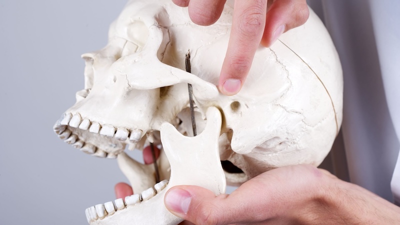 Artrite dell'articolazione temporomandibolare